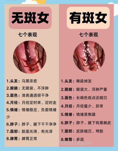 女性祛斑的几个小窍门