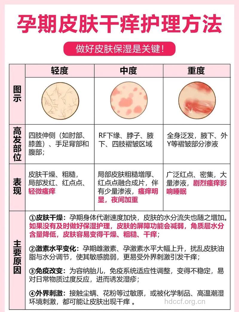 孕妇皮肤问题全攻略