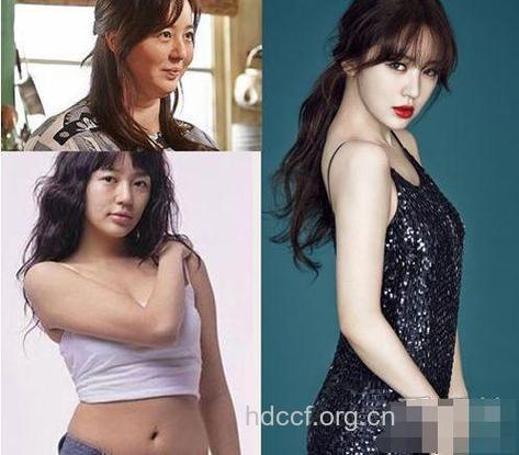 韩国女星减肥前后对比照
