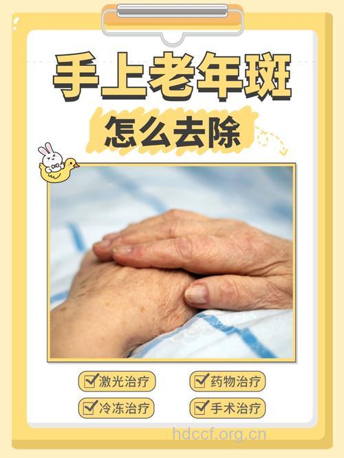 老人如何去除手部的老年斑