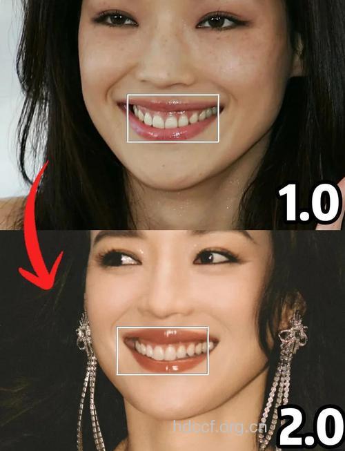 好莱坞女星的10个牙齿美白秘诀