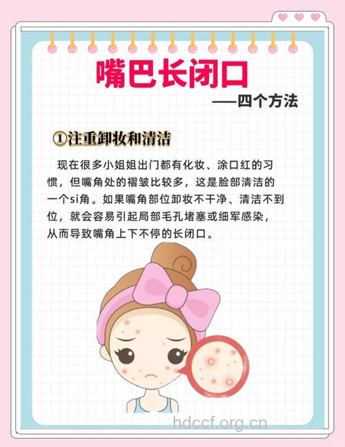 嘴角粉刺怎么办 3急救法