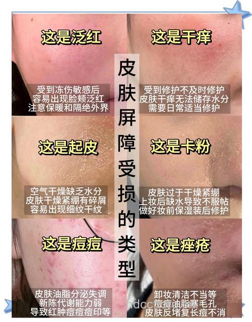 解决你的皮肤干燥问题