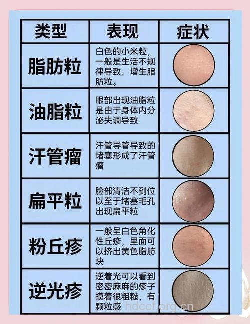 脂肪粒与护肤品并无直接关系