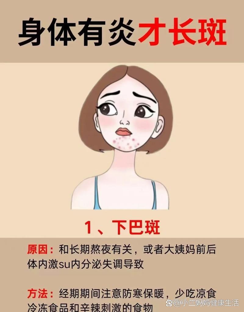 不同部位长斑的原因