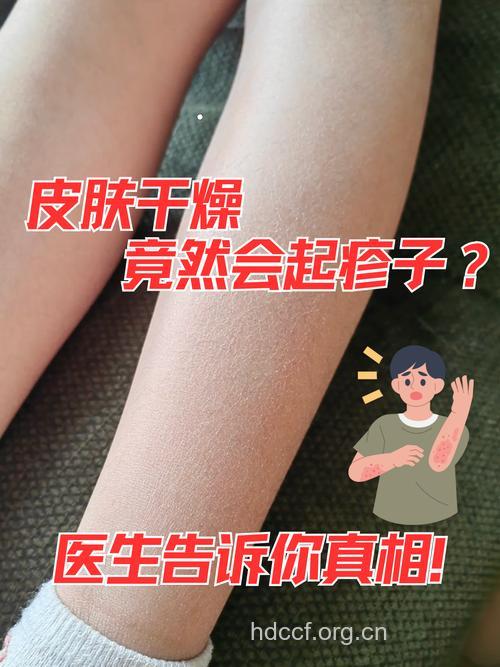 中医改善粗糙爱起疙瘩的皮肤
