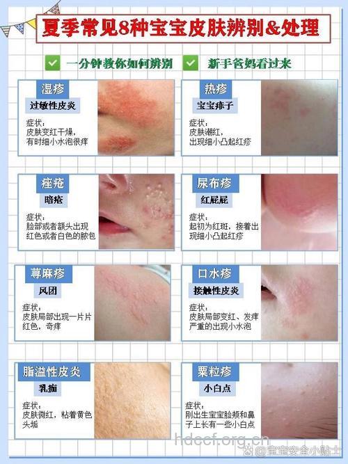 夏季肌肤会出现哪些问题