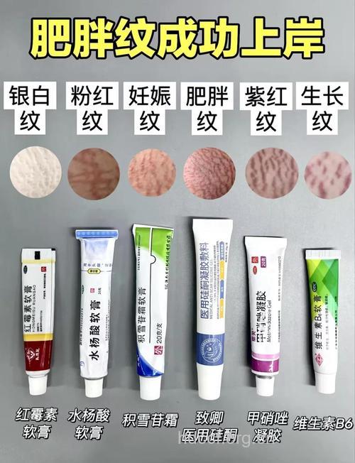 肥胖纹怎么消除?