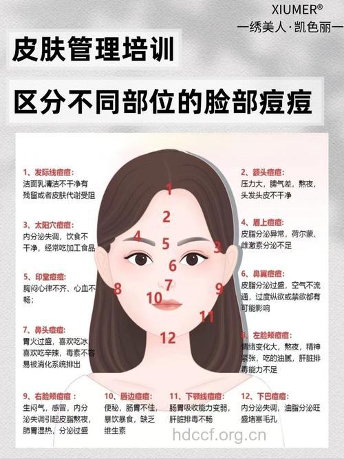 怎么面对脸部不同区域的痘痘