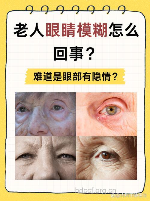 老人眼睛模糊小心四种眼病