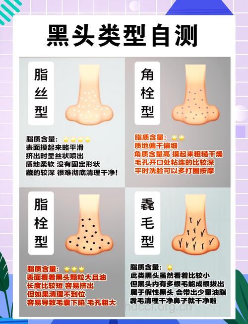 民间祛黑头偏方有用吗