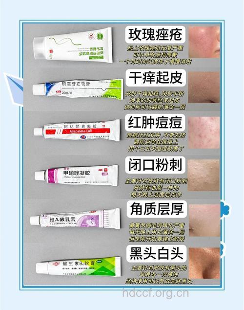 怎么用药治疗痘痘问题方法