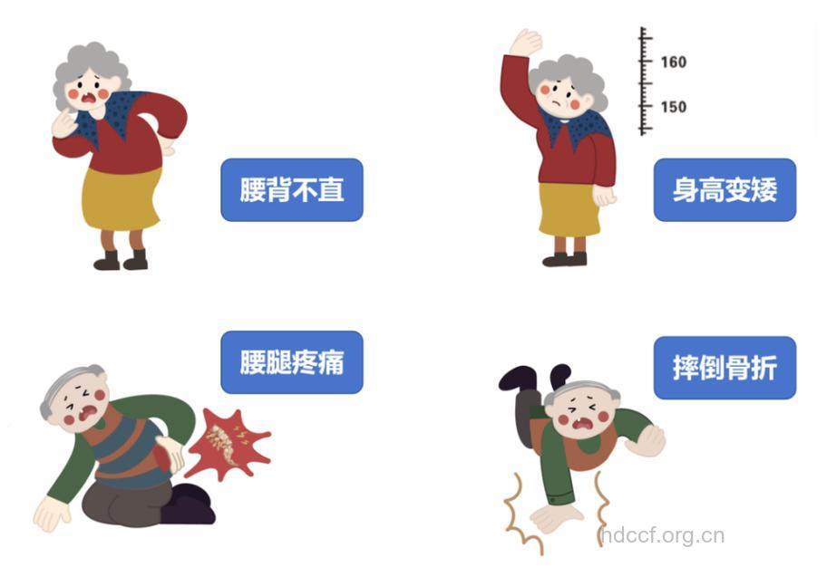 老年人骨质疏松的临床症状