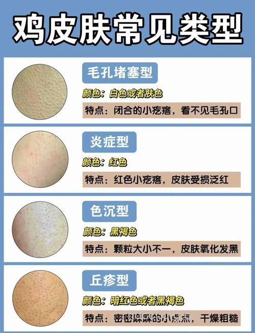 让皮肤变糟的五件“蠢事”