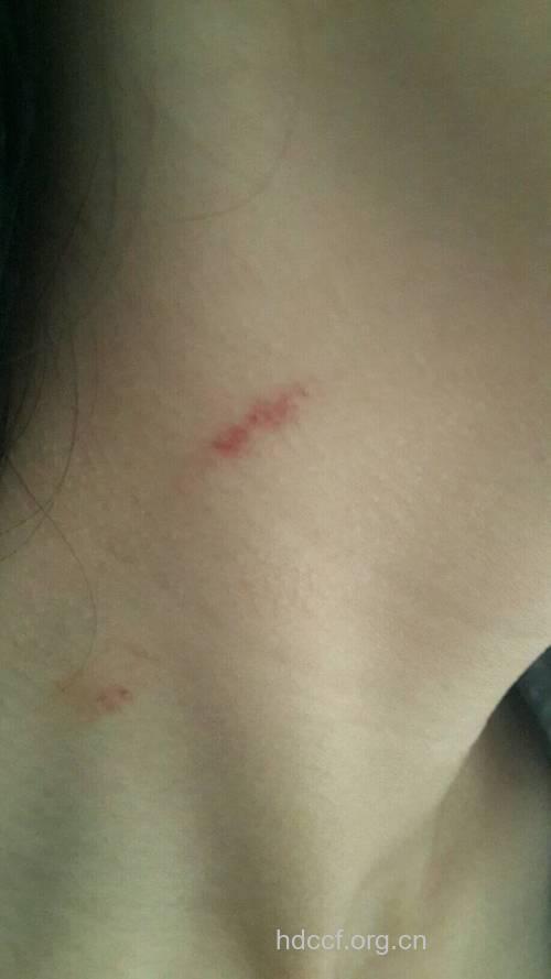 阳光吻痕,用心告别