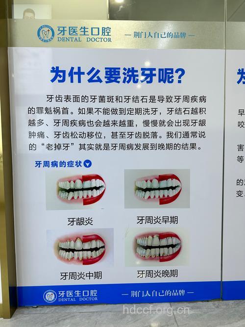 牙齿清洁有什么好处