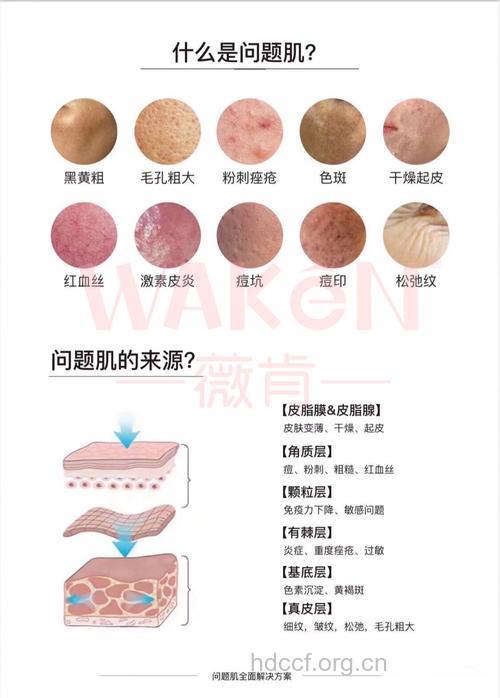 皮肤去角质的9大疑问