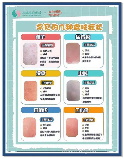夏日各种肌肤问题的对策