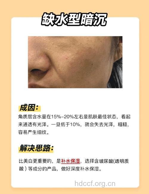 解决暗沉肌有什么妙招