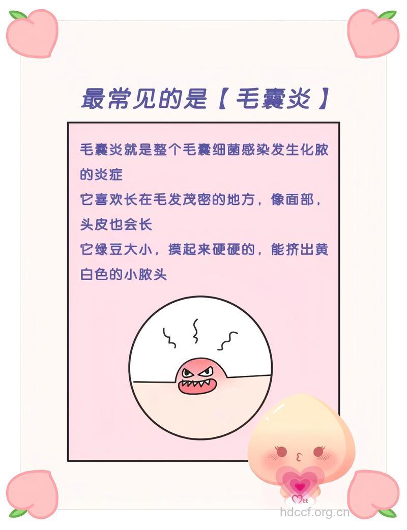 夏季脱毛小心预防毛囊炎
