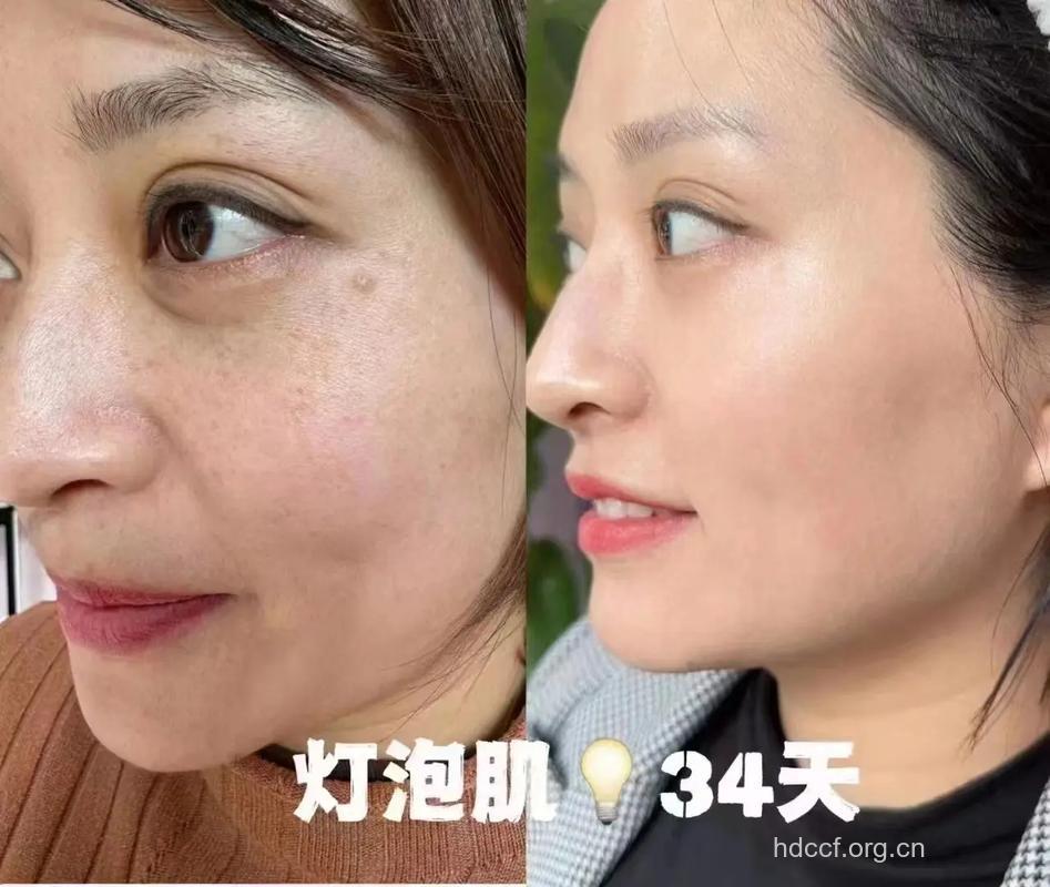 如何让黄脸婆变成白皙美人