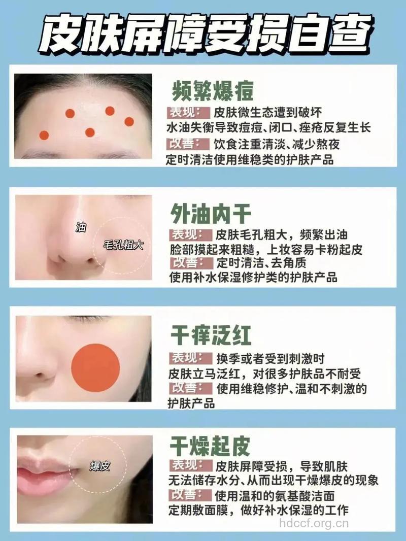 干性皮肤春季要如何给皮肤保湿