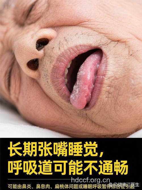 老人张嘴睡觉的危害