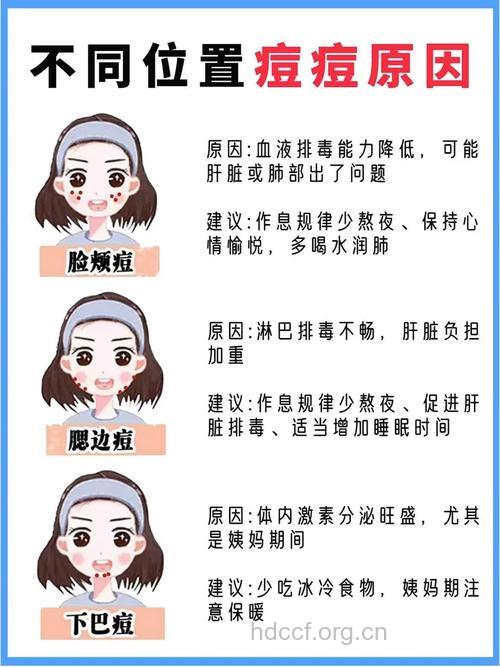 痘痘容易发部位原因大分析