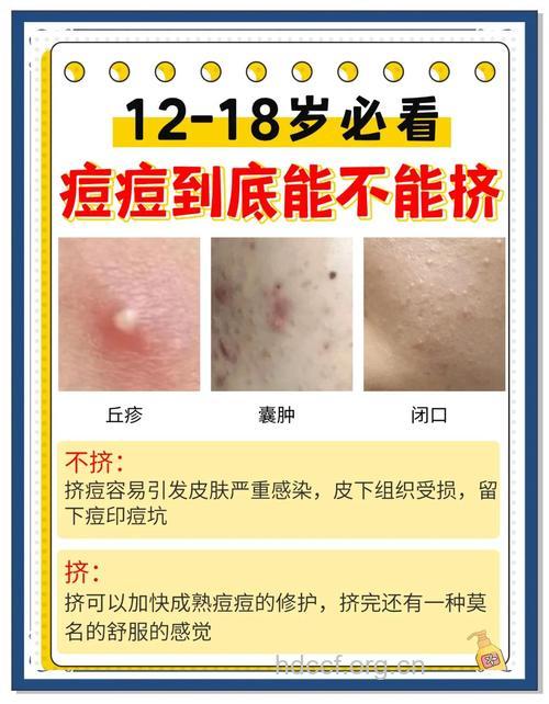 青春已逝痘还在恼人痘痘如何消？