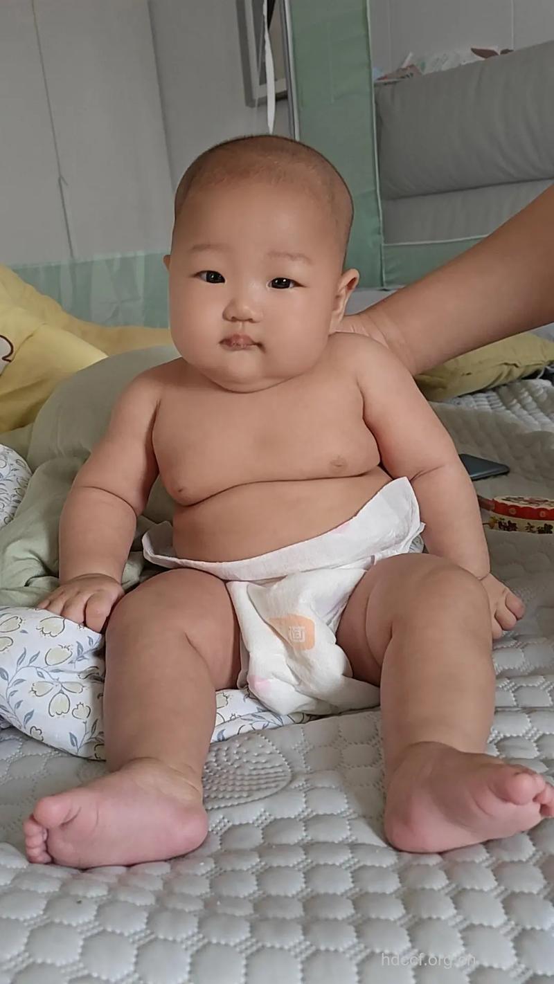 婴幼儿肥胖有哪些特点