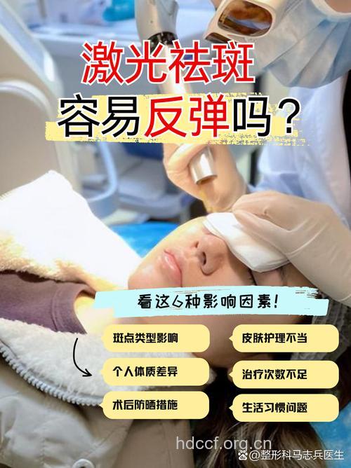 秋季做激光祛斑会反弹吗