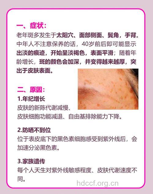 祛除老年斑的医学方法