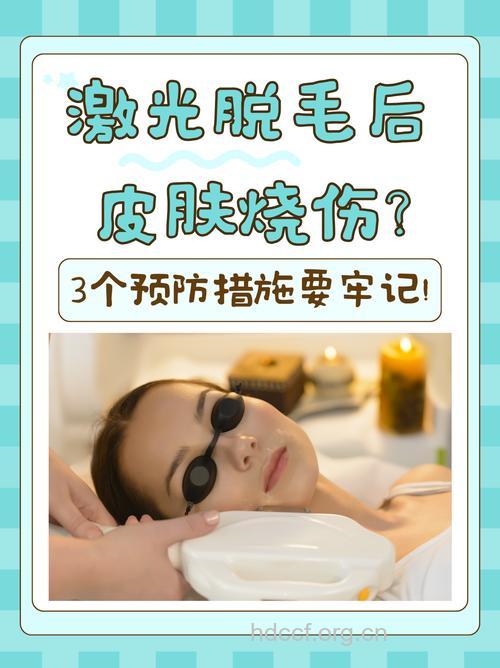 激光脱毛要防皮肤灼伤
