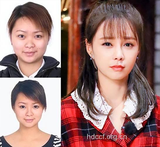 不用整容24小时还你瓜子脸