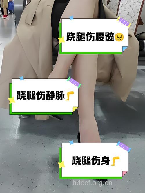 常跷二郎腿可能会导致腿部静脉曲张