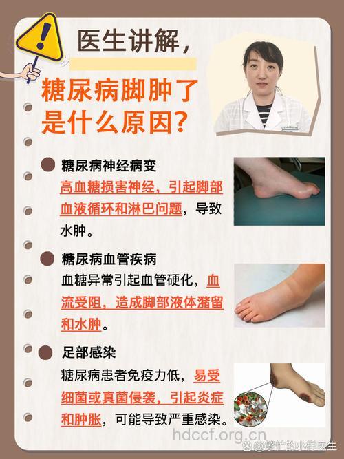 老年人糖尿病患者脚肿怎么办?