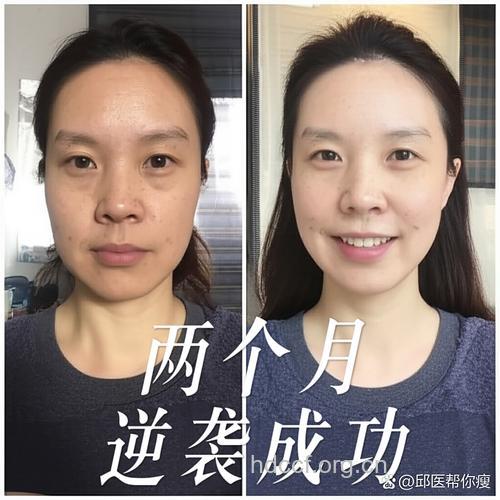 从黄脸婆到娇妻水嫩驻颜术