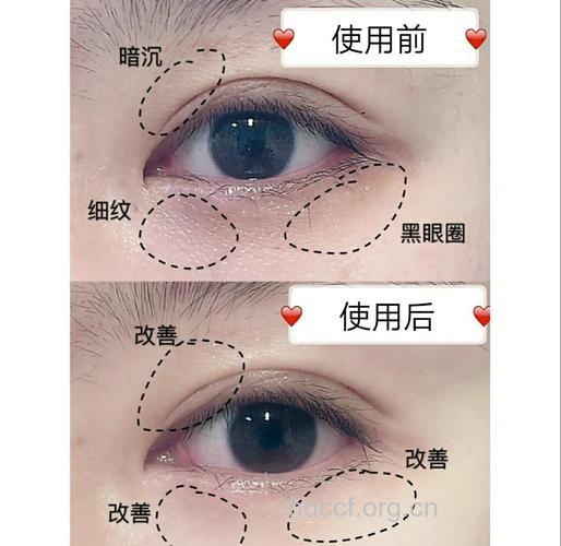 快速修复眼部干纹的窍门