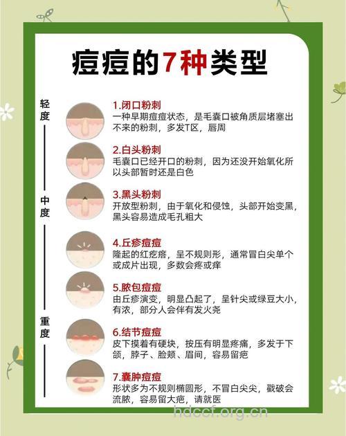 秋季祛除痘痘的4个重点