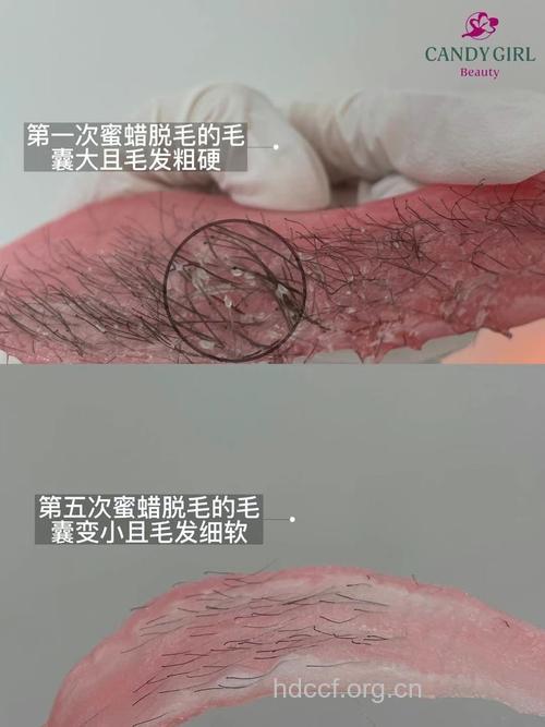 蜜蜡脱毛有哪些特点