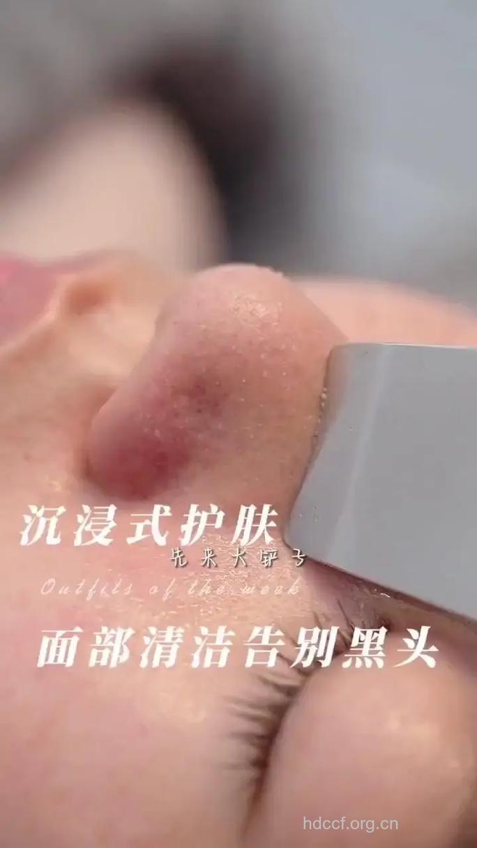 王心凌教你祛黑头的小妙招