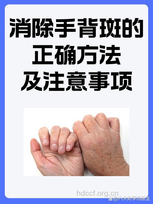 惊！按摩手背可缓解老年斑