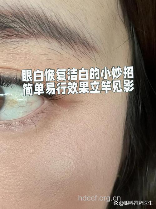 银耳 轻松祛除眼部细纹