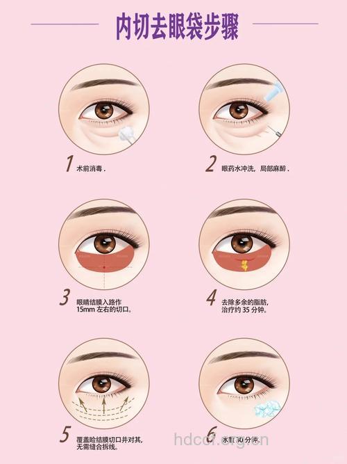 护肤学堂：教你怎么去眼袋