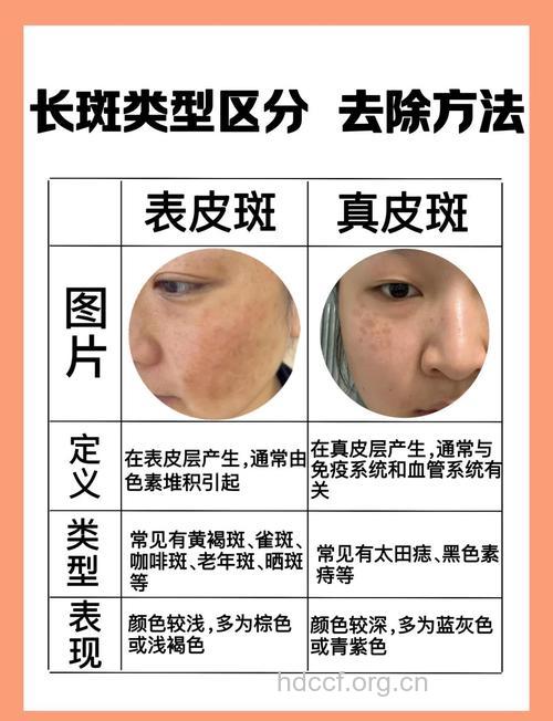 皮肤显示的色斑与健康关系