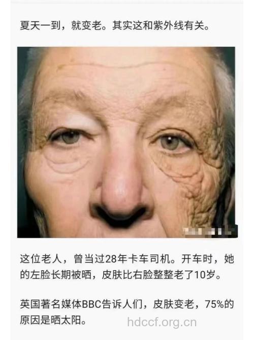 长期靠窗坐 让皮肤速老10岁