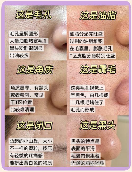 缩毛孔 的方法知多少