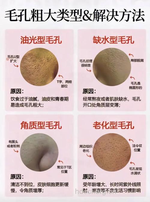 毛孔有哪些分类