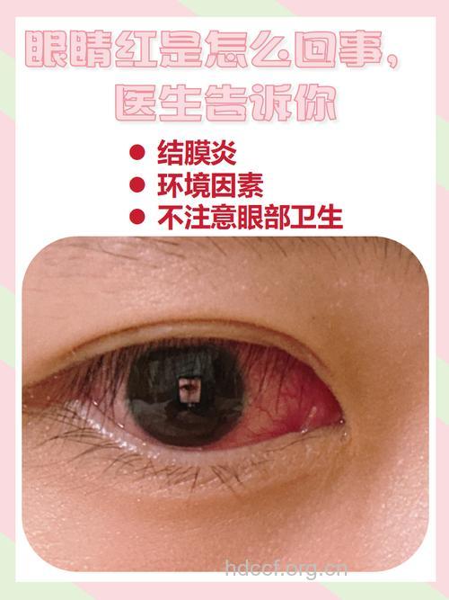 上年纪的人眼睛发红要提防