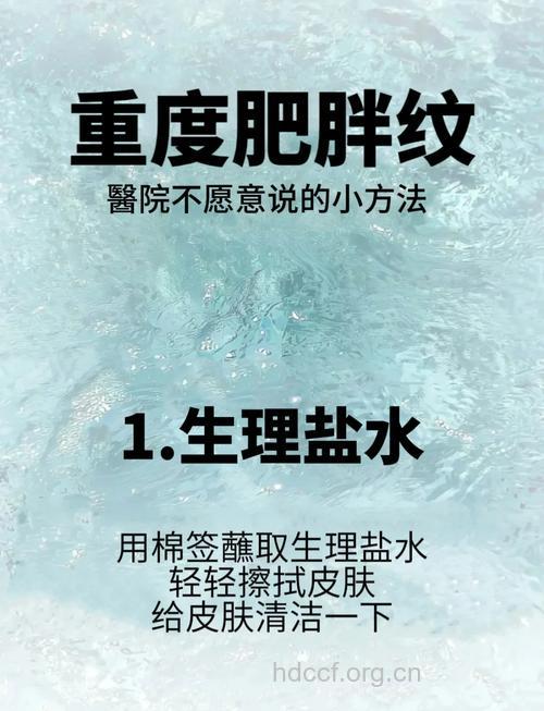 肥胖纹怎么办 4招淡化肥胖纹